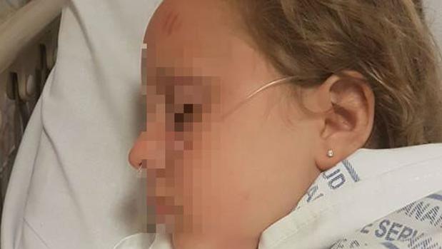 Una niña, herida al enredarse el pelo con el filtro de la piscina del hotel