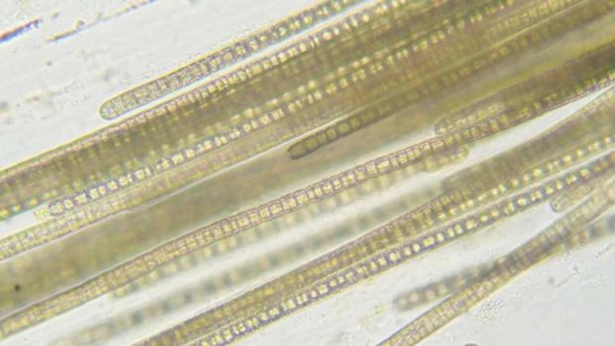 Imagen microscópica de las algas que tienen este verano una presencia anormal en las islas