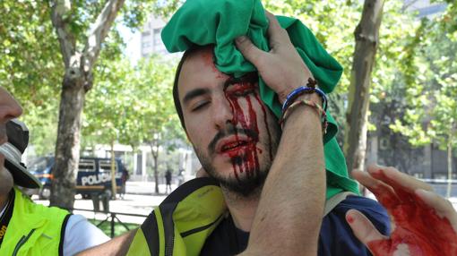 El secesionismo difundió imágenes de heridos en otros eventos de hace cinco años