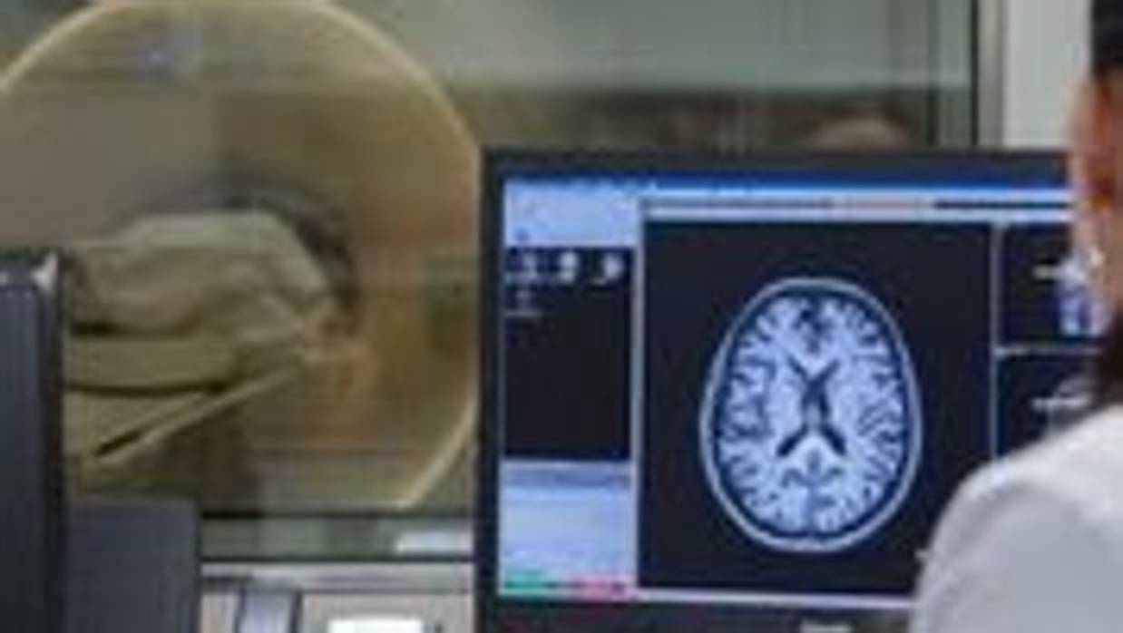 Las resonancias magnéticas revelan si hay indicios de la enfermedad en el cerebro