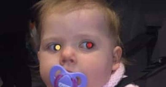 La foto que delató el cáncer de ojo de la niña