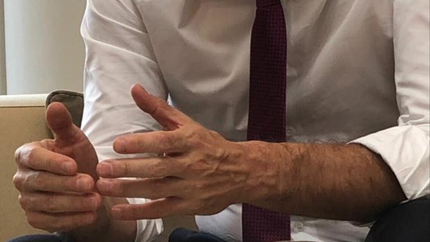 Sánchez, sobre los reportajes fotográficos de sus manos: «Corramos un tupido velo»