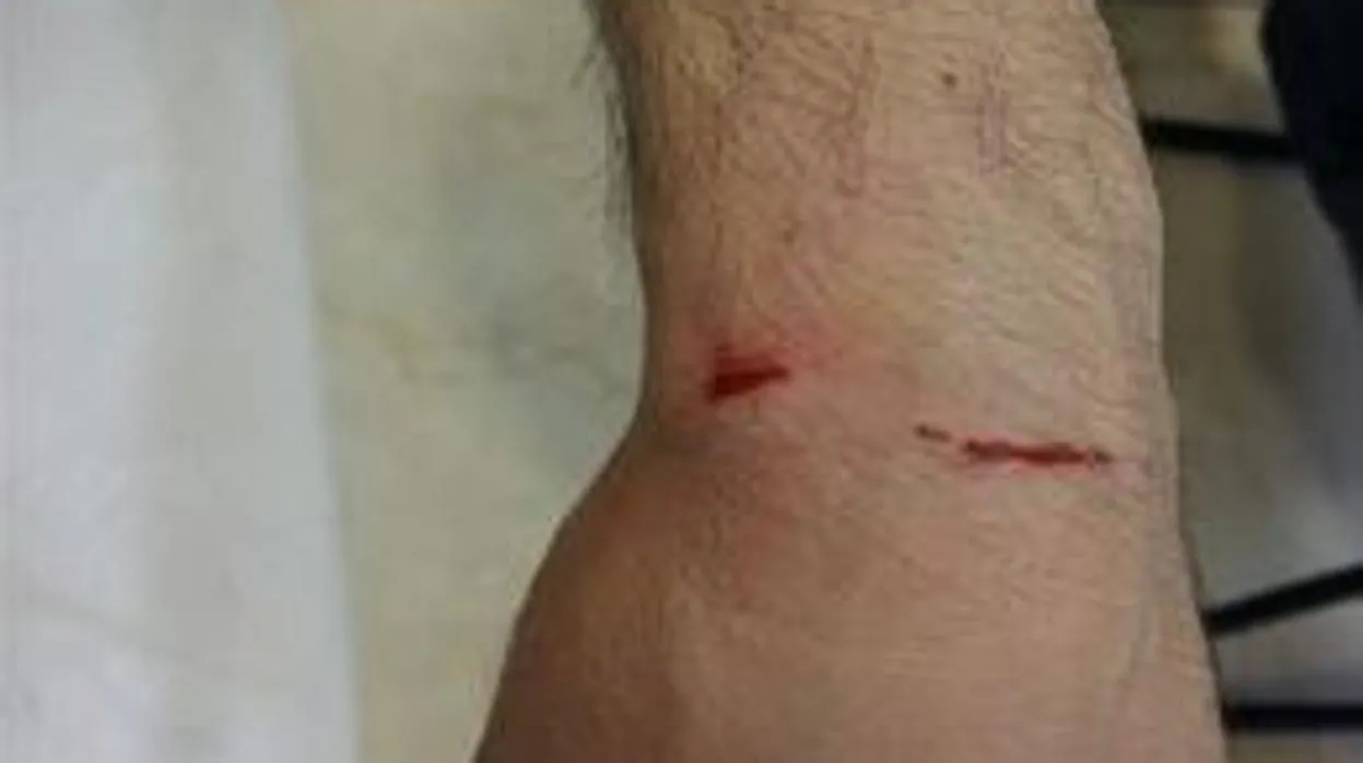 Heridas causadas a la víctima tras la agresión