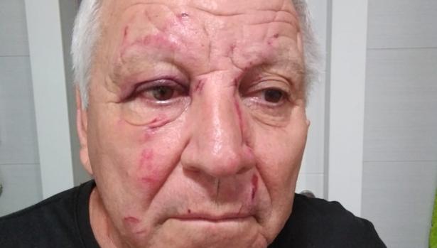 «Me insultó primero, me arañó la cara y no me acuerdo si le mordí»