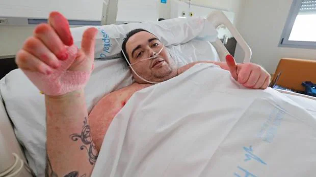 El joven con obesidad mórbida sale del hospital tras cuatro meses ingresado