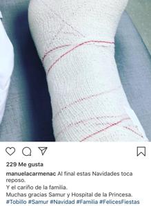 Carmena publica en su Instagram el vendaje tras su caída