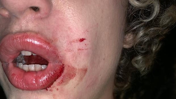 Agresión homófoba en Valencia: atacan a un joven a la salida de una discoteca