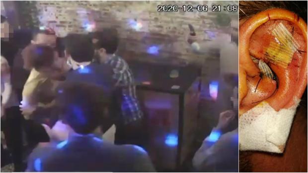 El toque de queda dispara las peleas de bar antes de la medianoche