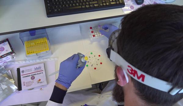 Desarrollan un sistema que detecta el coronavirus en la saliva en media hora y por dos euros