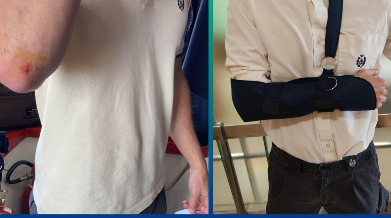 Dos de los funcionarios agredidos muestran sus lesiones