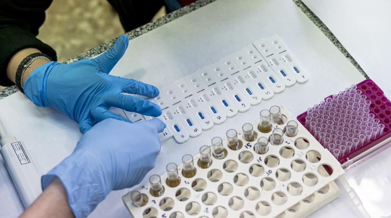 Imagen de archivo de diferentes pruebas diagnósticas de coronavirus en un hospital ubicado en Valencia