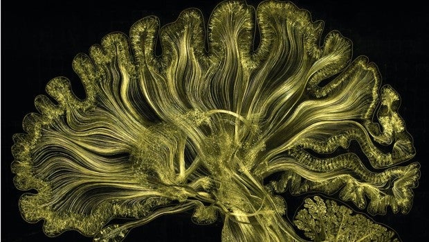 Viaje al centro del cerebro en la nueva temporada del CCCB