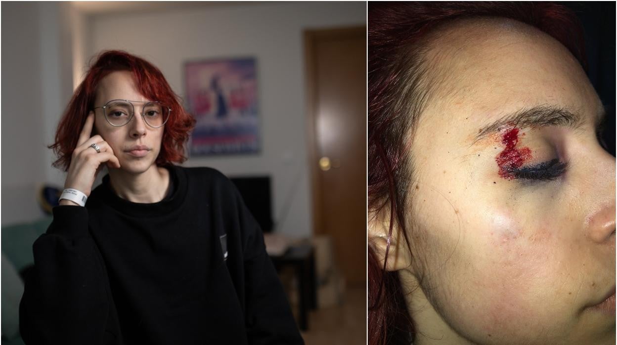 A la izquierda, la víctima, ayer en su domicilio; a la derecha, la noche de la agresión