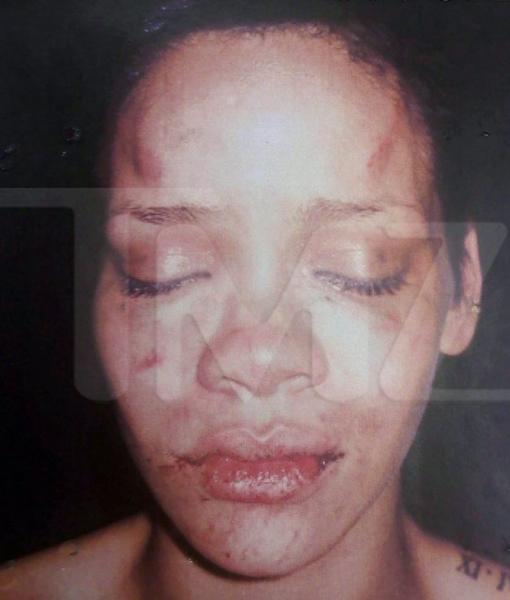 Imagen de la cantante Rihanna tras la agresión