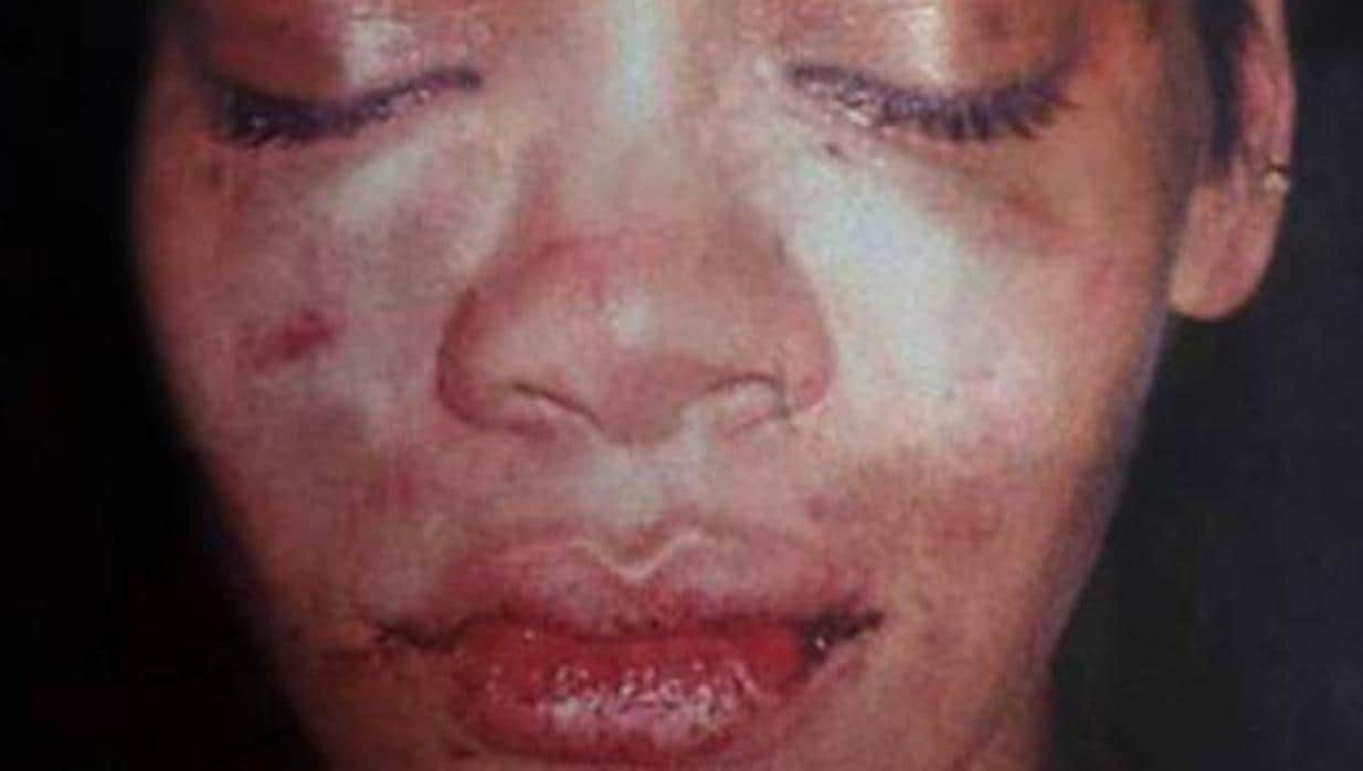 Una imagen de Rihanna tras la brutal paliza