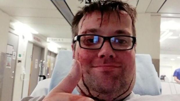 Vídeo: Un youtuber recibe una brutal paliza por lucir una camiseta de Franco