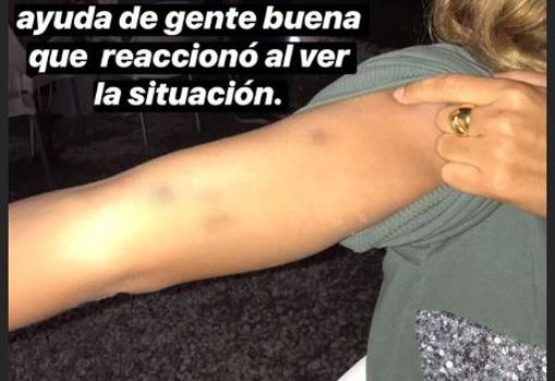 María Pombo, brutalmente atacada por defender a los hombres tras el asesinato de Laura Luelmo