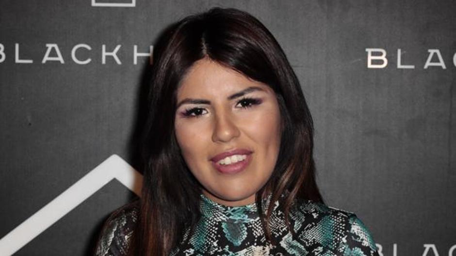 Chabelita y su nueva operación estética