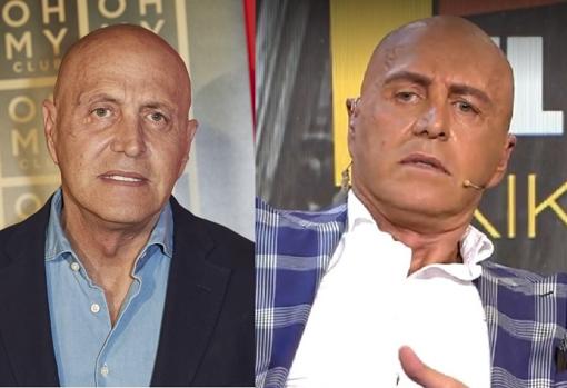 El antes y el después de las cejas de Kiko Matamoros