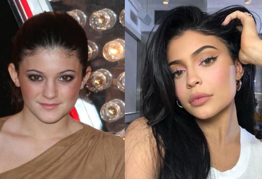 Kylie Jenner cumple 22: así es su aspecto después de innumerables operaciones