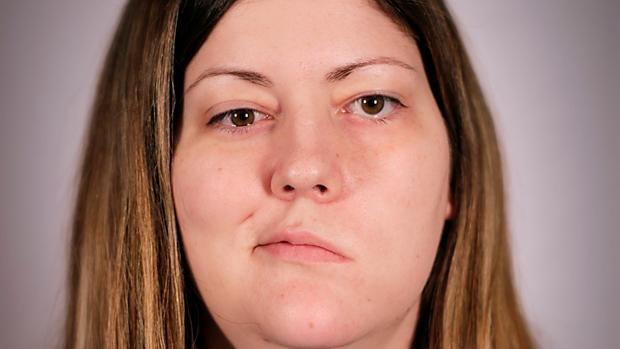 «Me cambió la vida cuando me diagnosticaron un tumor cerebral con 19 años»