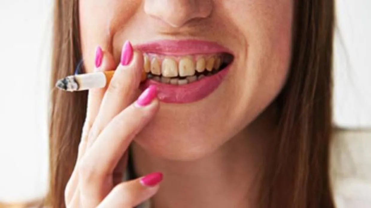 El tabaco, gran enemigo de los dientes y del equilibrio bacteriano de la boca