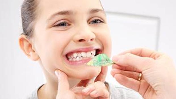 Ortodoncia interceptiva en niños: cuándo empezar y cómo prevenir problemas futuros