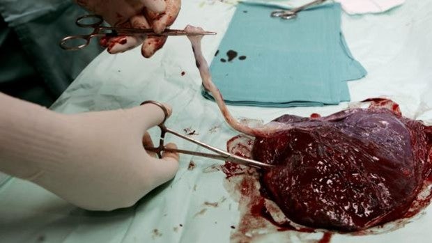 La placenta es un «vertedero» de defectos genéticos que ayuda al feto a evitarlos