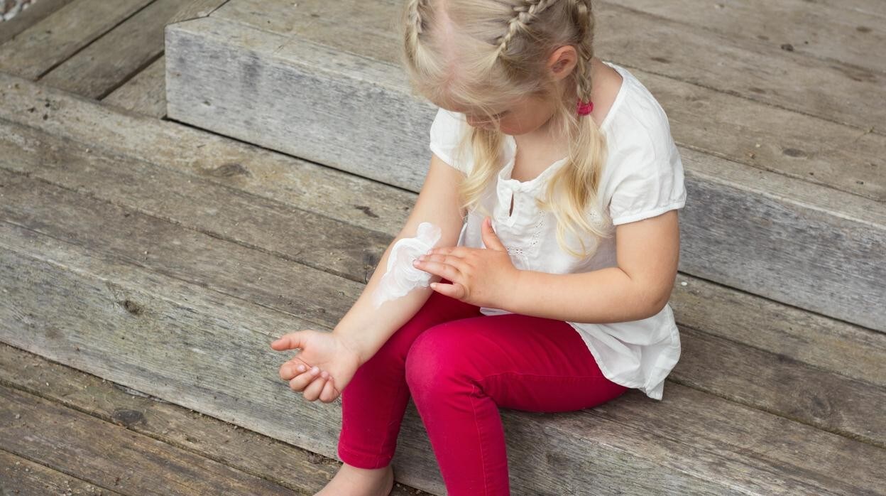 ¡Cuidado! Estas son las alergias que más afectan a los niños en verano