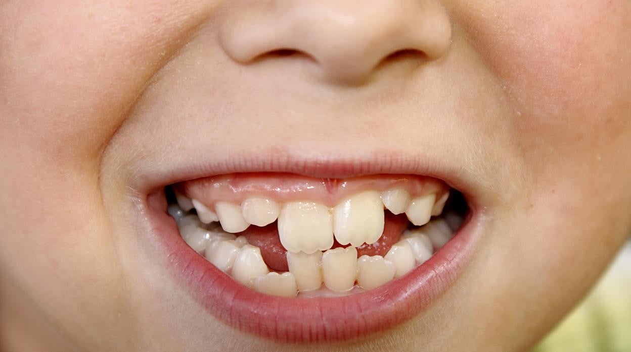 Cuándo es el mejor momento para ponerle ortodoncia a tu hijo adolescente