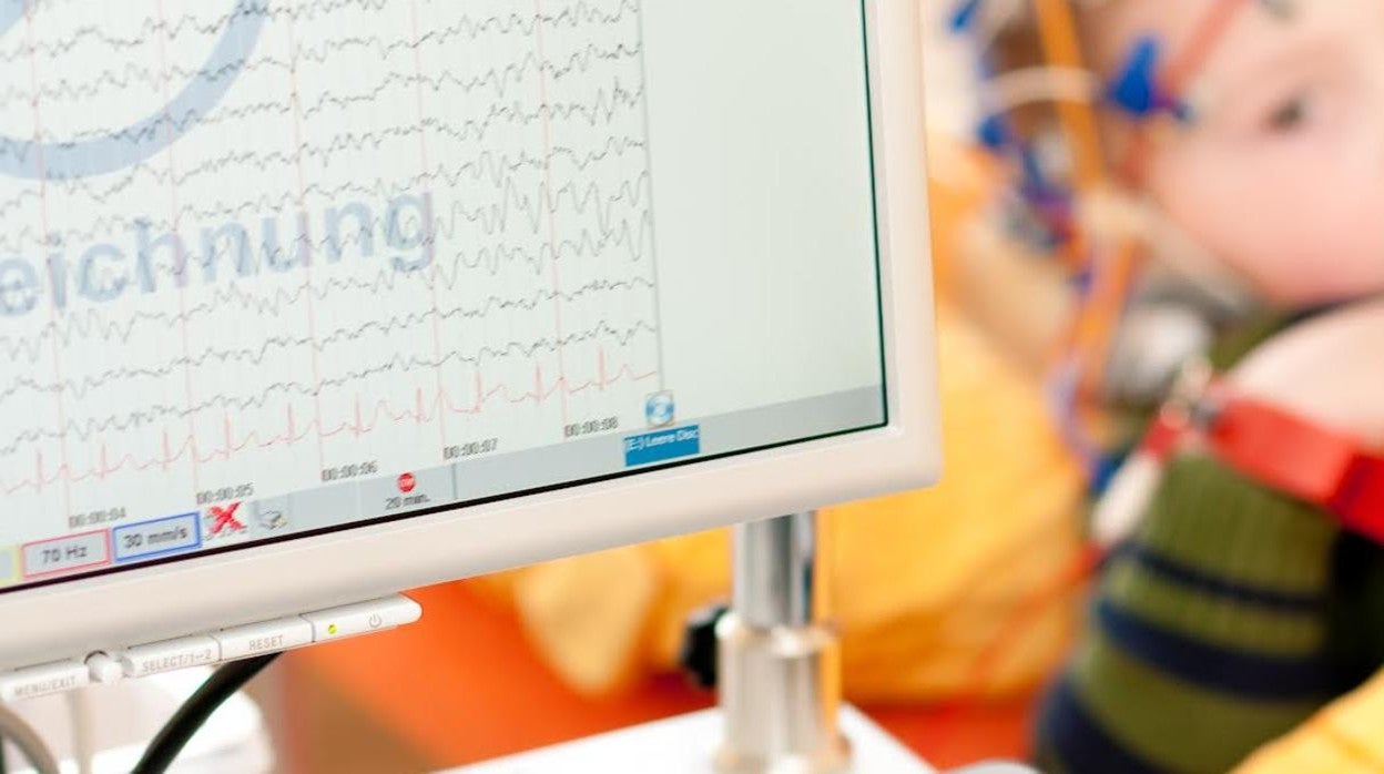 La dieta con la que el pequeño Luccas consigue controlar sus crisis de epilepsia