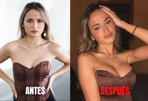 Antes y después de Gal·la