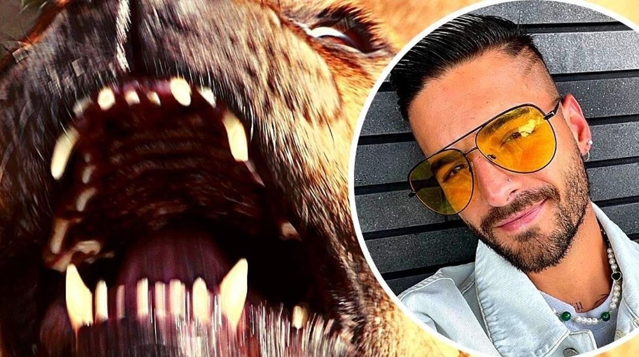 Así ha quedado Maluma después de ser atacado por su perro