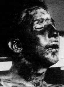 El cadáver de Anteo Zamboni, poco después de ser linchado