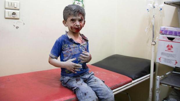 Un niño sirio es atendido en un hospital tras resultar herido en uno de los bombardeos a Alepo