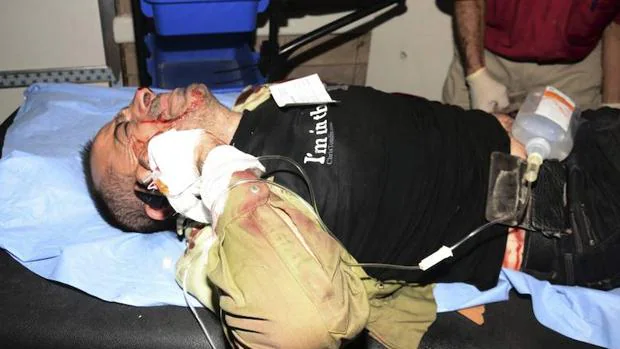 Un hombre herido recibe asistencia médica en un hospital de Alepo