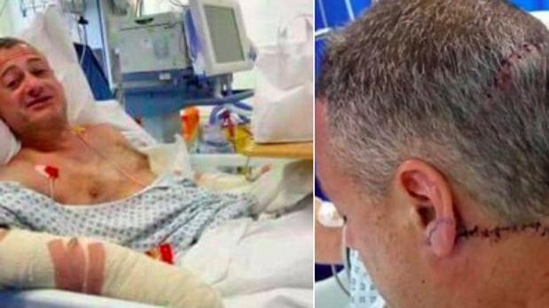 Roy Larner, de 47 años, ingresado en el hospital tras los ataques