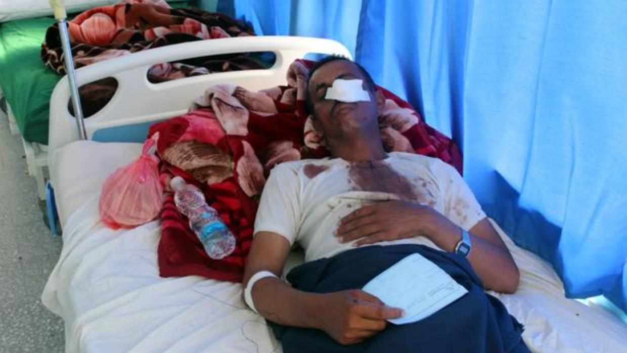 Un hombre herido en el bombardeo durante una boda en Yemen, en un hospital