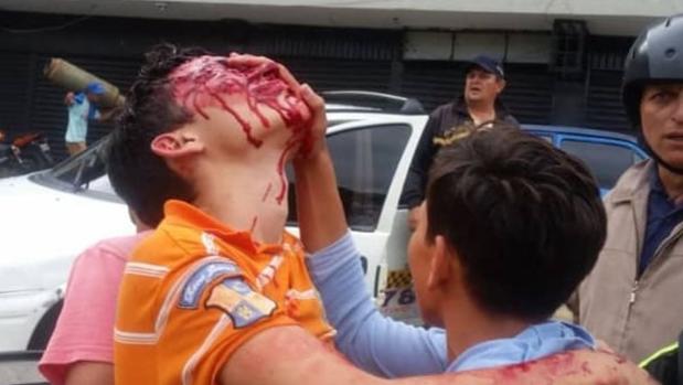 Un joven pierde la vista por los perdigones disparados por la policía durante una protesta en Venezuela