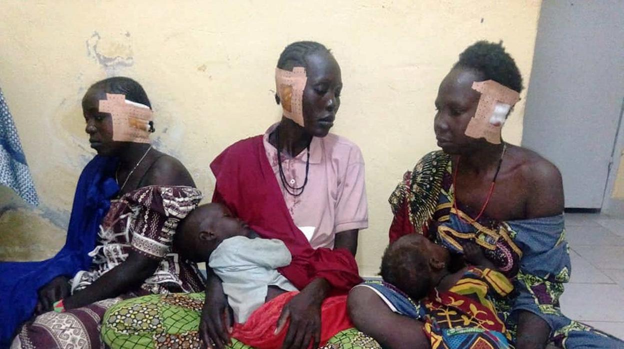 Mujeres a las que los yihadistas de Boko Haram mutilaron las orejas en Camerún, en una imagen publicada en 2019