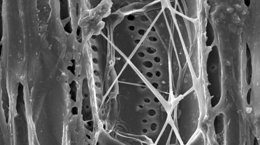 Fotografía realizada mediante un microscopio que muestra el hongo patógeno de la grafiosis (Ophiostoma novo-ulmi) colonizando un elemento vascular de la madera de un olmo