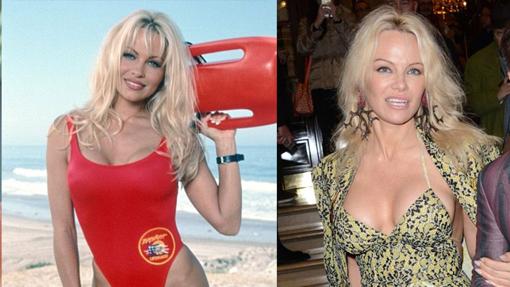 Pamela Anderson mantiene su atractivo a base de bisturí