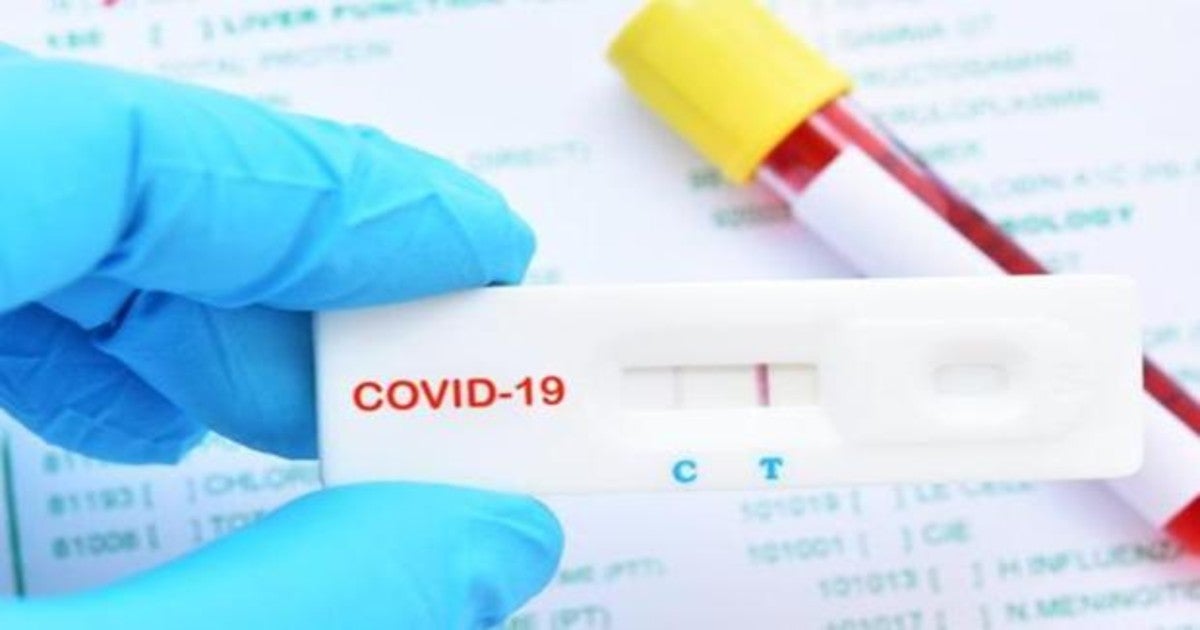 Test para detectar el virus Covid-19.