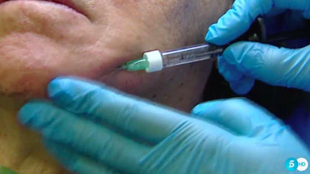 Informativos Telecinco recomienda inyectarse bótox para «mejorar» en Navidad