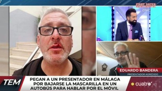 El violento ataque a un presentador de Canal Sur por bajarse la mascarilla «Me vi lleno de sangre»