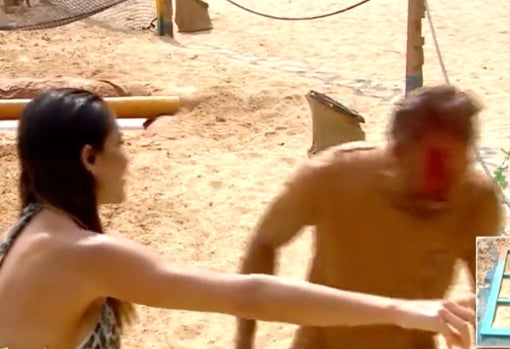 El concursante con la cara ensangrentada