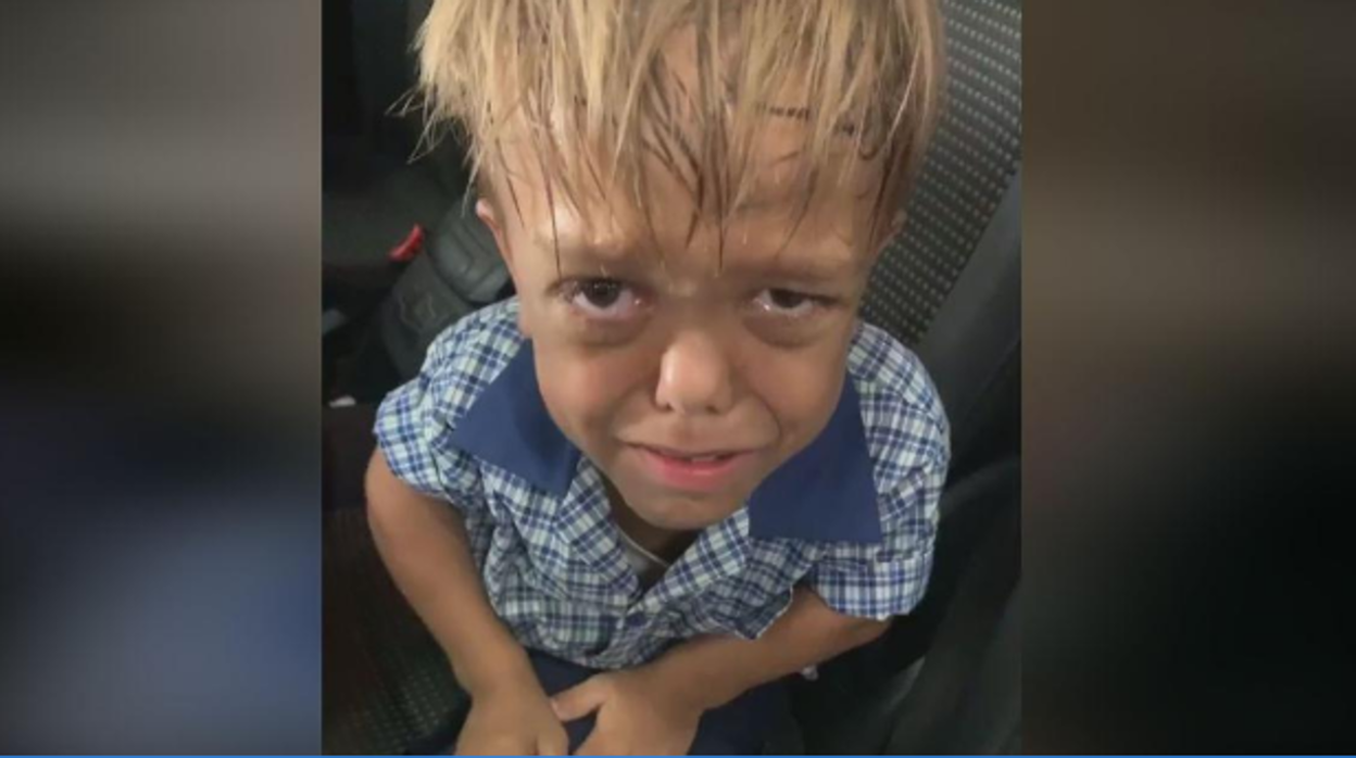 El niño con enanismo que se hizo viral por sufrir acoso escolar, fichado para la nueva película de &#039;Mad Max&#039;