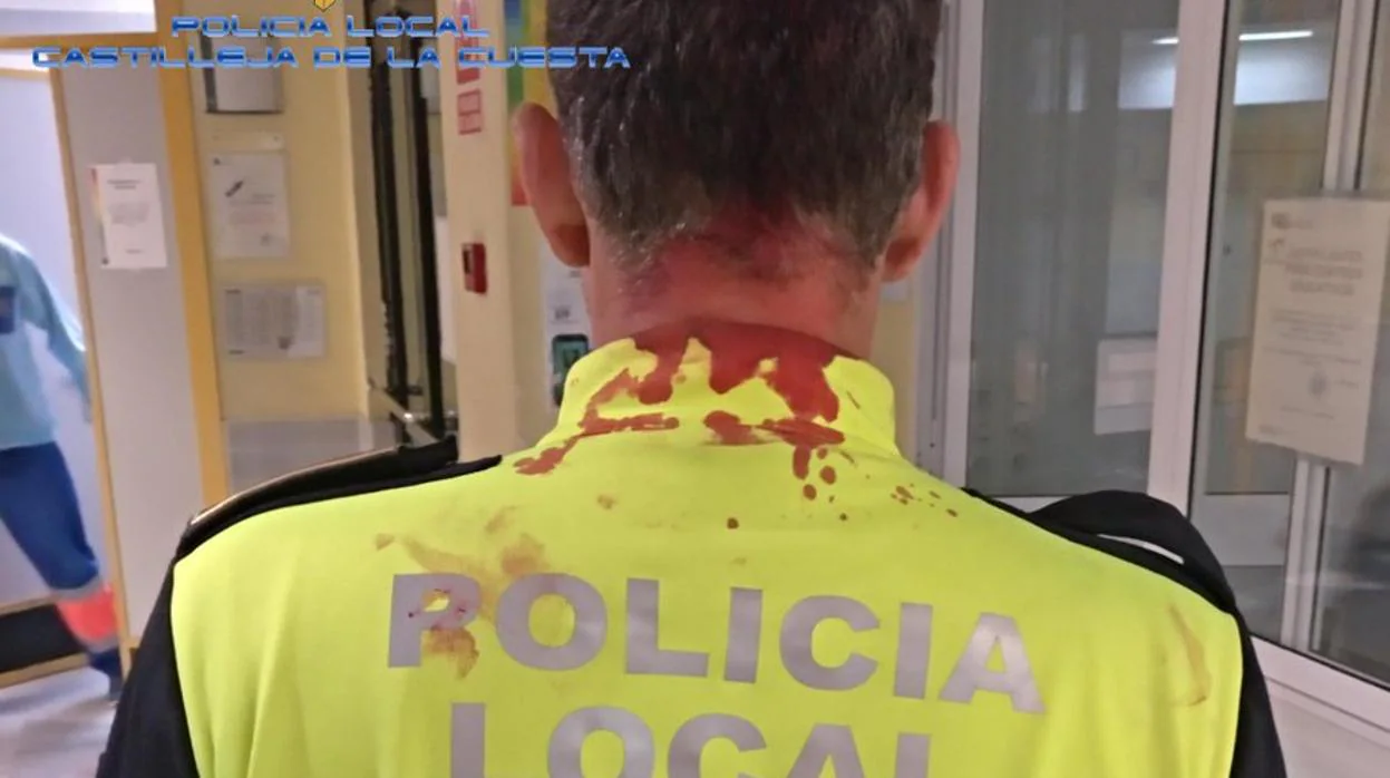 Imagen del policía herido