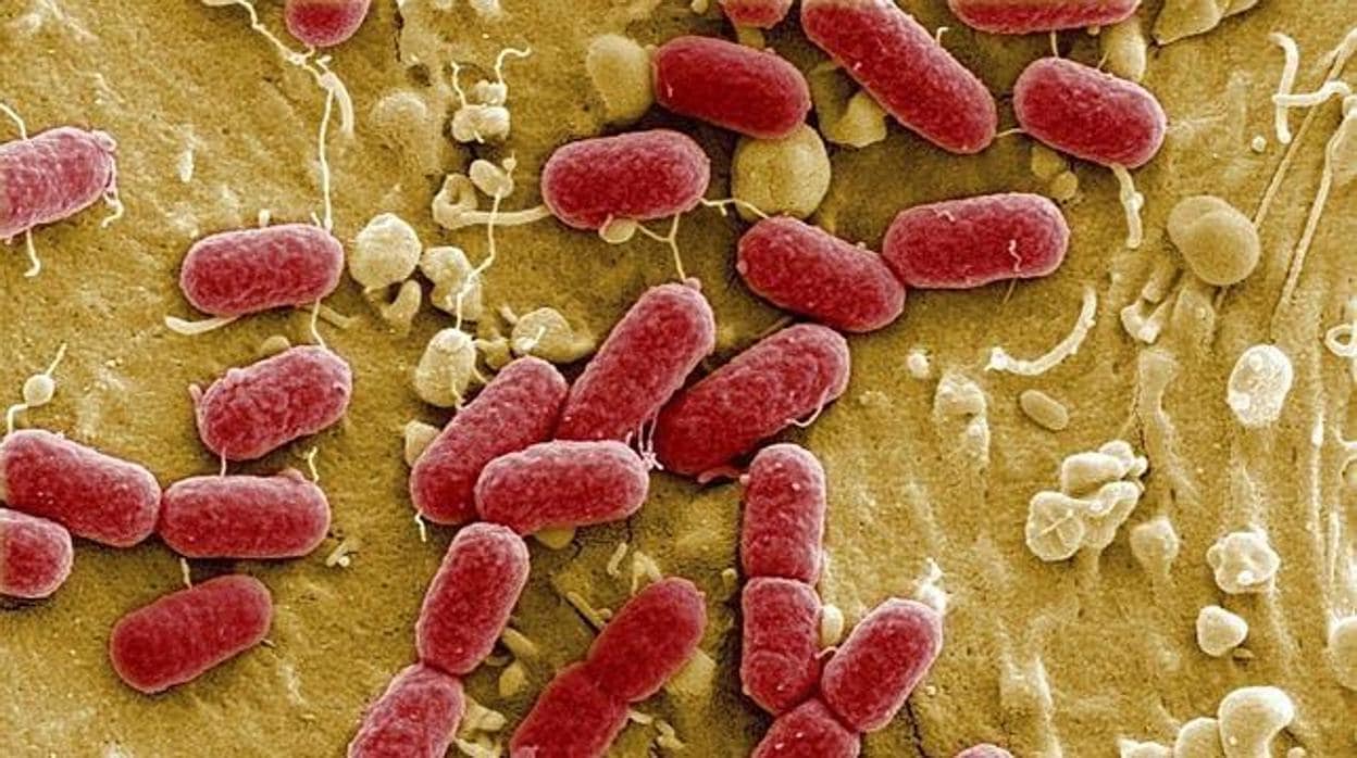 ¿Qué es el E. coli y cómo afecta esta bacteria que obliga a cerrar la playa de Fuentebravía?