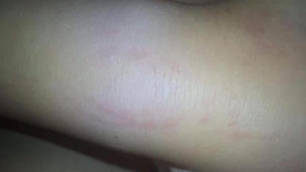 Los padres de la niña autista de Dos Hermanas denuncian que la menor también sufrió maltrato físico